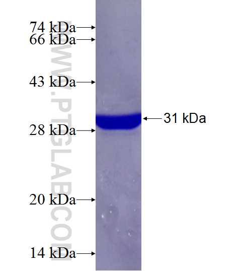 MT1X fusion protein Ag10711 SDS-PAGE