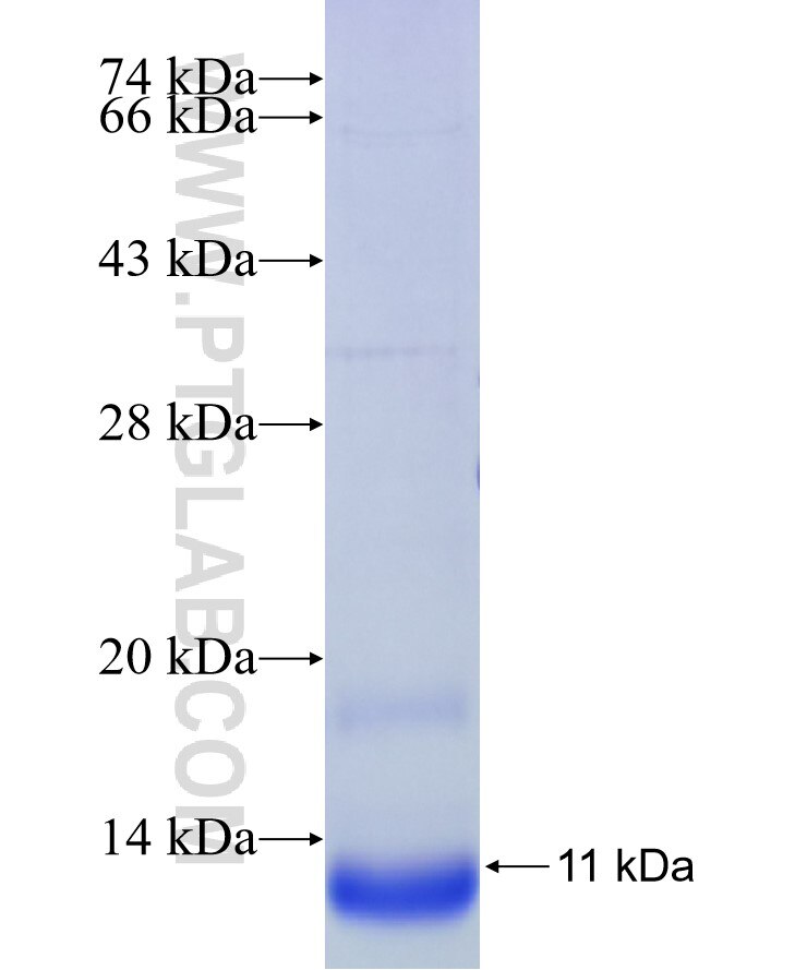 MT1X fusion protein Ag10940 SDS-PAGE