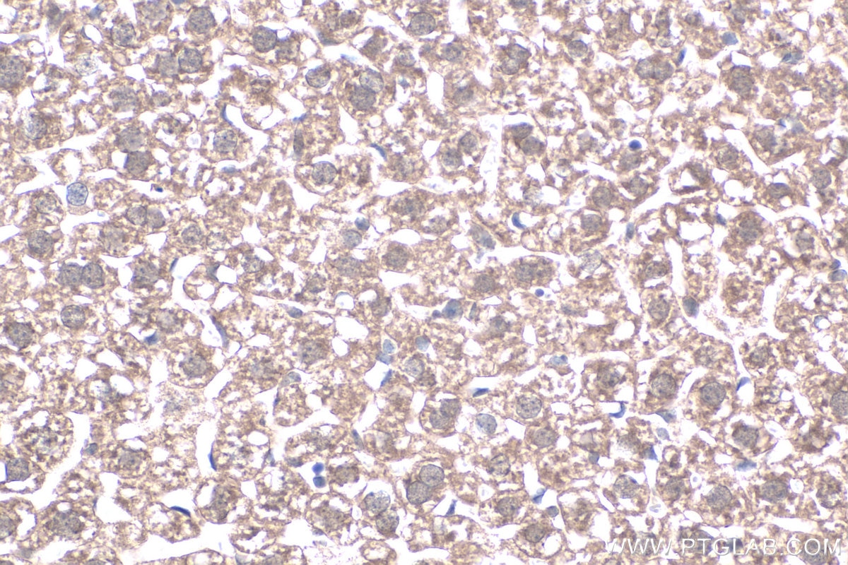 IHC staining of mouse liver using 20809-1-AP Immunohistochemistry (IHC) staining of mouse liver tissue using MT2A Polyclonal antibody (20809-1-AP)