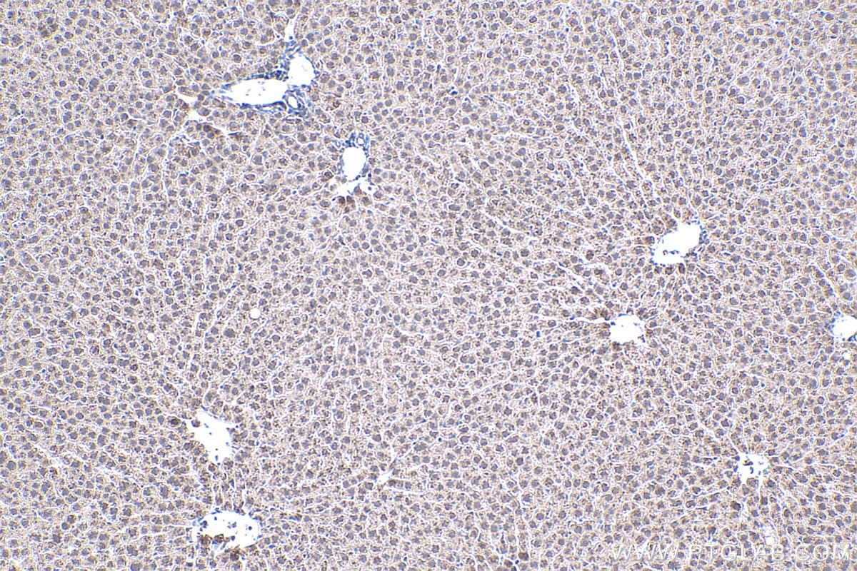 IHC staining of rat liver using 20809-1-AP Immunohistochemistry (IHC) staining of rat liver tissue using MT2A Polyclonal antibody (20809-1-AP)