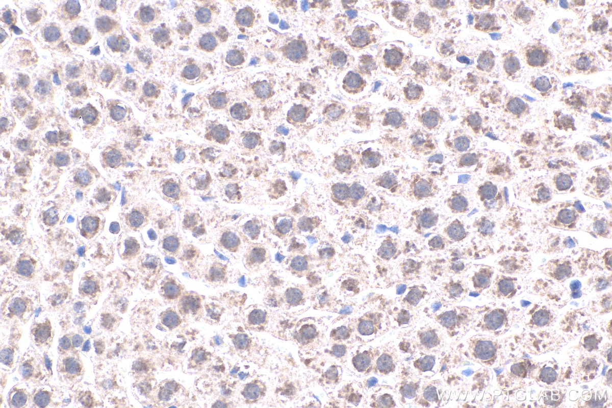 IHC staining of rat liver using 20809-1-AP Immunohistochemistry (IHC) staining of rat liver tissue using MT2A Polyclonal antibody (20809-1-AP)