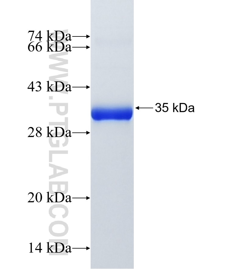 MT2A fusion protein Ag14761 SDS-PAGE