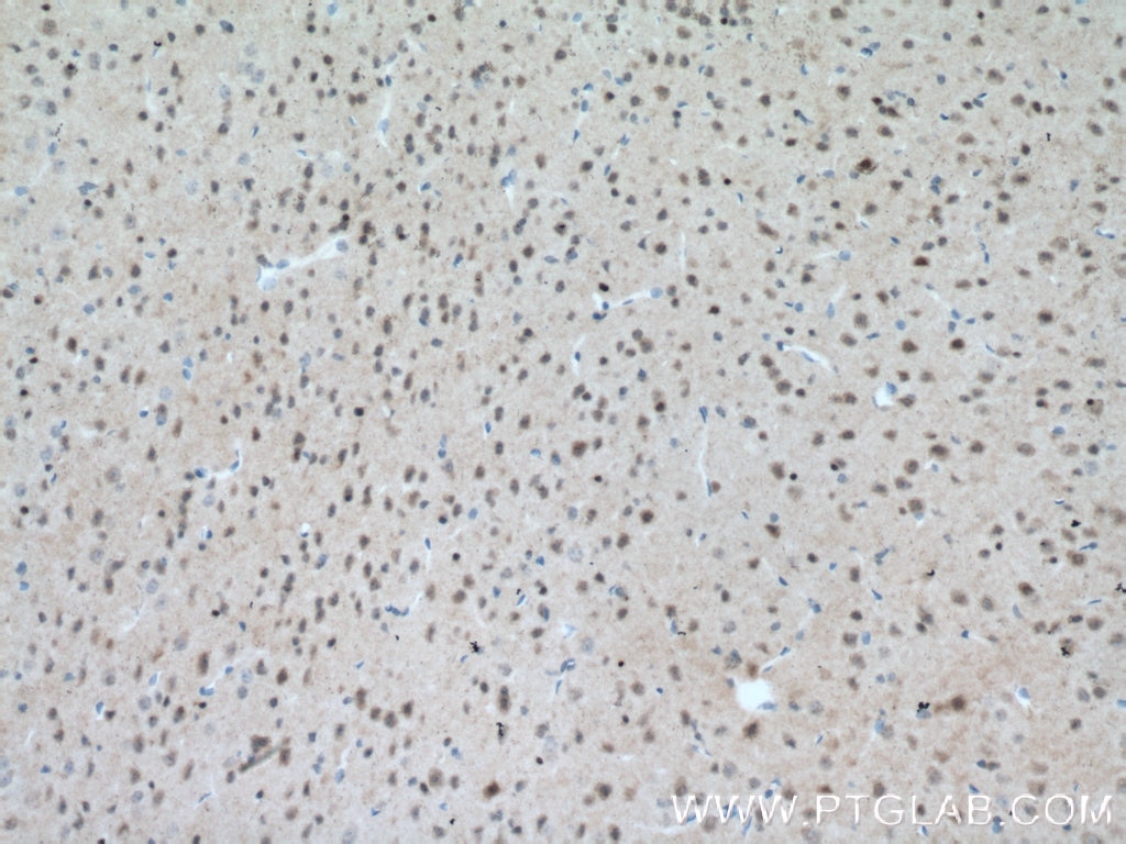 Immunohistochemistry (IHC) staining of mouse brain tissue using MT3 Polyclonal antibody (12179-1-AP)