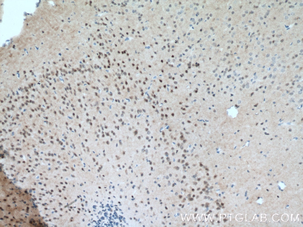 Immunohistochemistry (IHC) staining of mouse brain tissue using MT3 Polyclonal antibody (12179-1-AP)