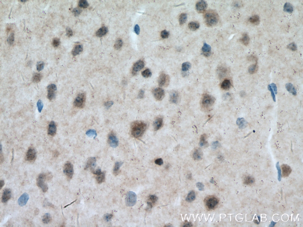 Immunohistochemistry (IHC) staining of mouse brain tissue using MT3 Polyclonal antibody (12179-1-AP)