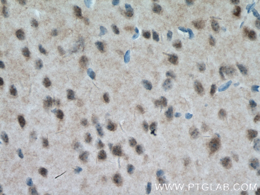 Immunohistochemistry (IHC) staining of mouse brain tissue using MT3 Polyclonal antibody (12179-1-AP)