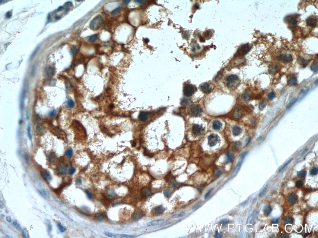 Immunohistochemistry (IHC) staining of human testis tissue using MT3 Polyclonal antibody (12179-1-AP)