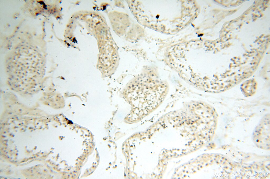 Immunohistochemistry (IHC) staining of human testis tissue using MT3 Polyclonal antibody (12179-1-AP)