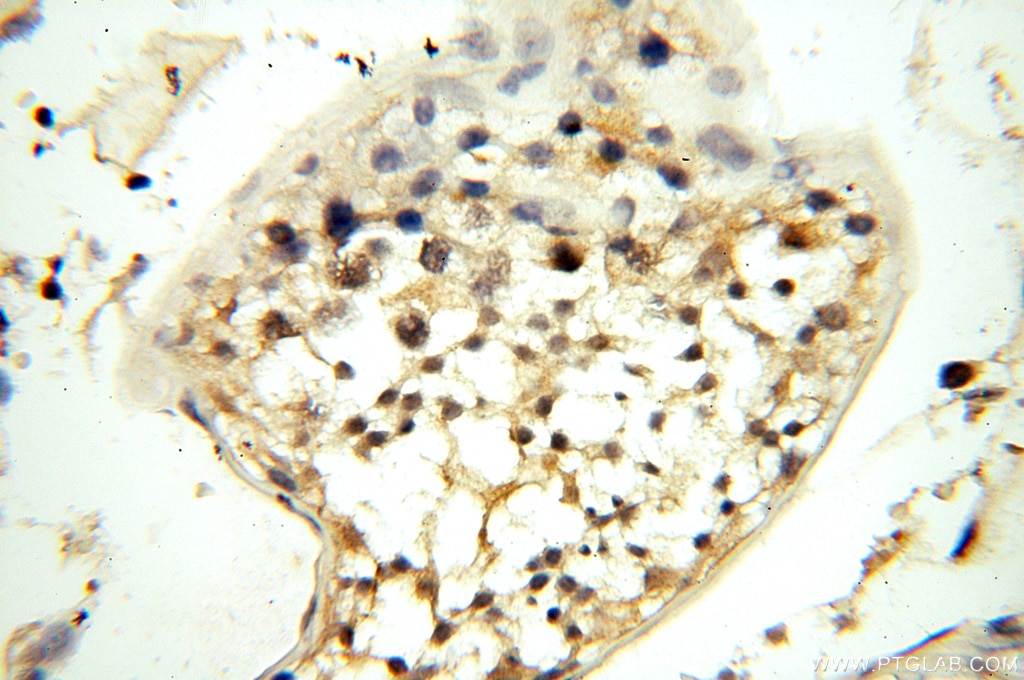 Immunohistochemistry (IHC) staining of human testis tissue using MT3 Polyclonal antibody (12179-1-AP)