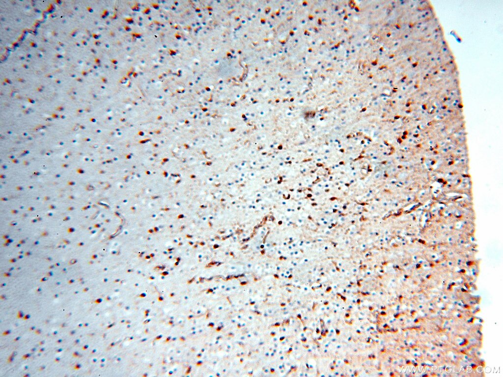 Immunohistochemistry (IHC) staining of human brain tissue using MT3 Polyclonal antibody (12179-1-AP)