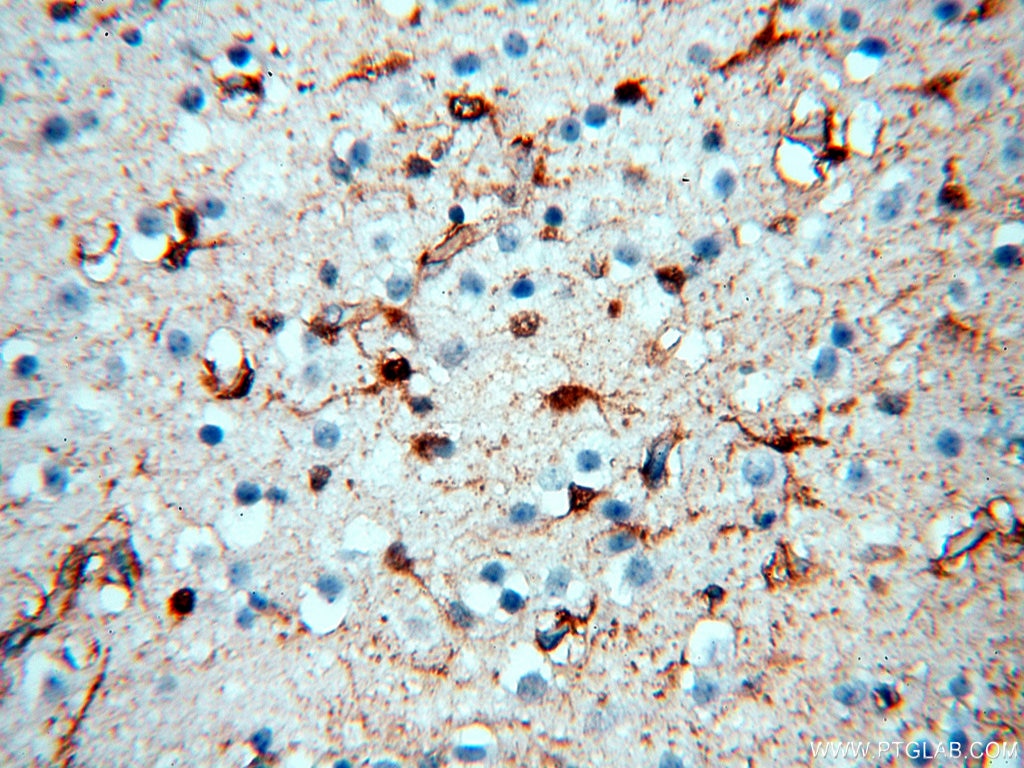 Immunohistochemistry (IHC) staining of human brain tissue using MT3 Polyclonal antibody (12179-1-AP)