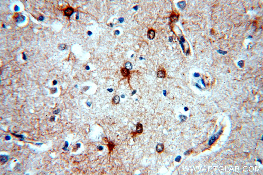 Immunohistochemistry (IHC) staining of human brain tissue using MT3 Polyclonal antibody (12179-1-AP)