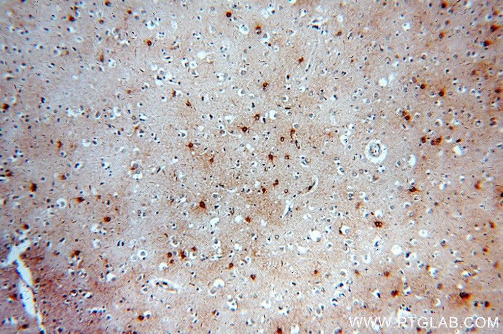 Immunohistochemistry (IHC) staining of human brain tissue using MT3 Polyclonal antibody (12179-1-AP)