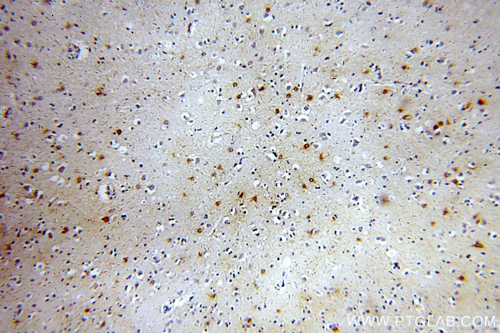 Immunohistochemistry (IHC) staining of human brain tissue using MT3 Polyclonal antibody (12179-1-AP)