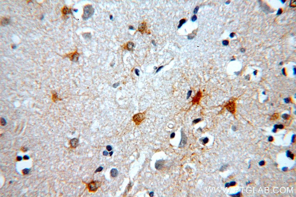 Immunohistochemistry (IHC) staining of human brain tissue using MT3 Polyclonal antibody (12179-1-AP)