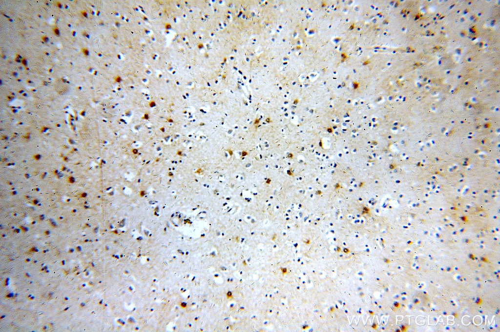 Immunohistochemistry (IHC) staining of human brain tissue using MT3 Polyclonal antibody (12179-1-AP)