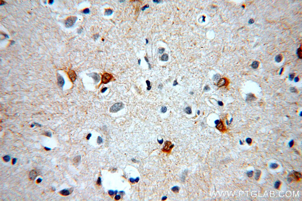 Immunohistochemistry (IHC) staining of human brain tissue using MT3 Polyclonal antibody (12179-1-AP)