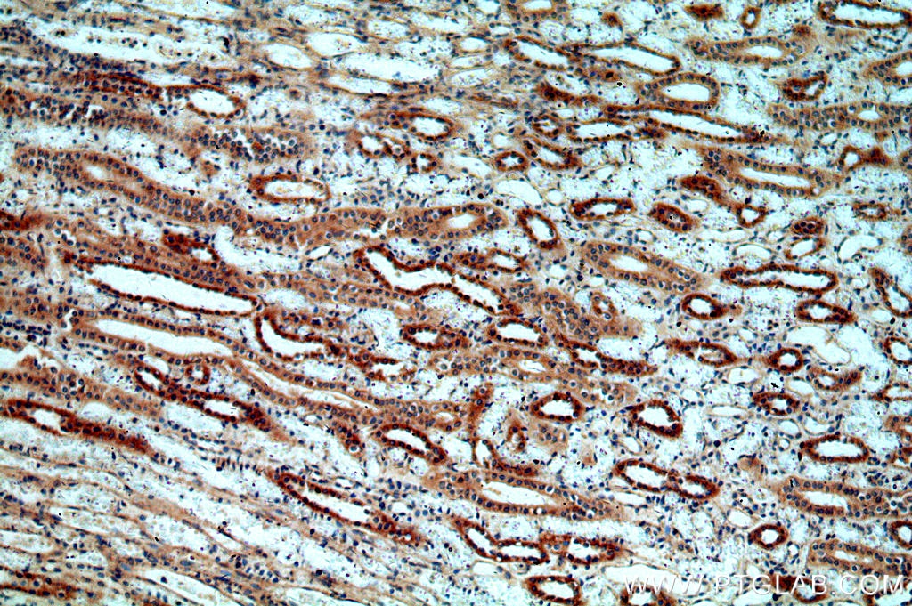 Immunohistochemistry (IHC) staining of human kidney tissue using MT3 Polyclonal antibody (12179-1-AP)