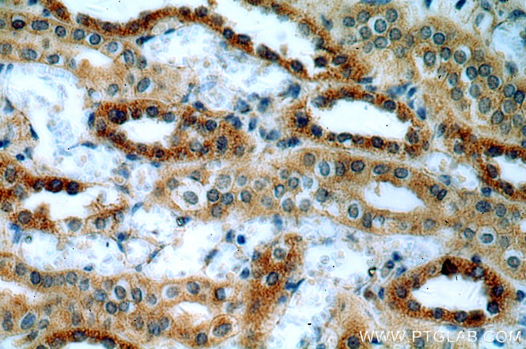 Immunohistochemistry (IHC) staining of human kidney tissue using MT3 Polyclonal antibody (12179-1-AP)