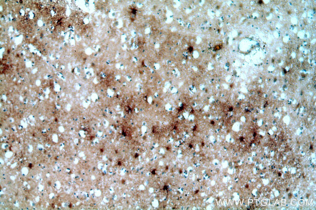 Immunohistochemistry (IHC) staining of human brain tissue using MT3 Polyclonal antibody (12179-1-AP)