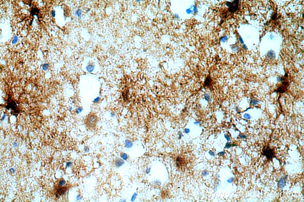 Immunohistochemistry (IHC) staining of human brain tissue using MT3 Polyclonal antibody (12179-1-AP)