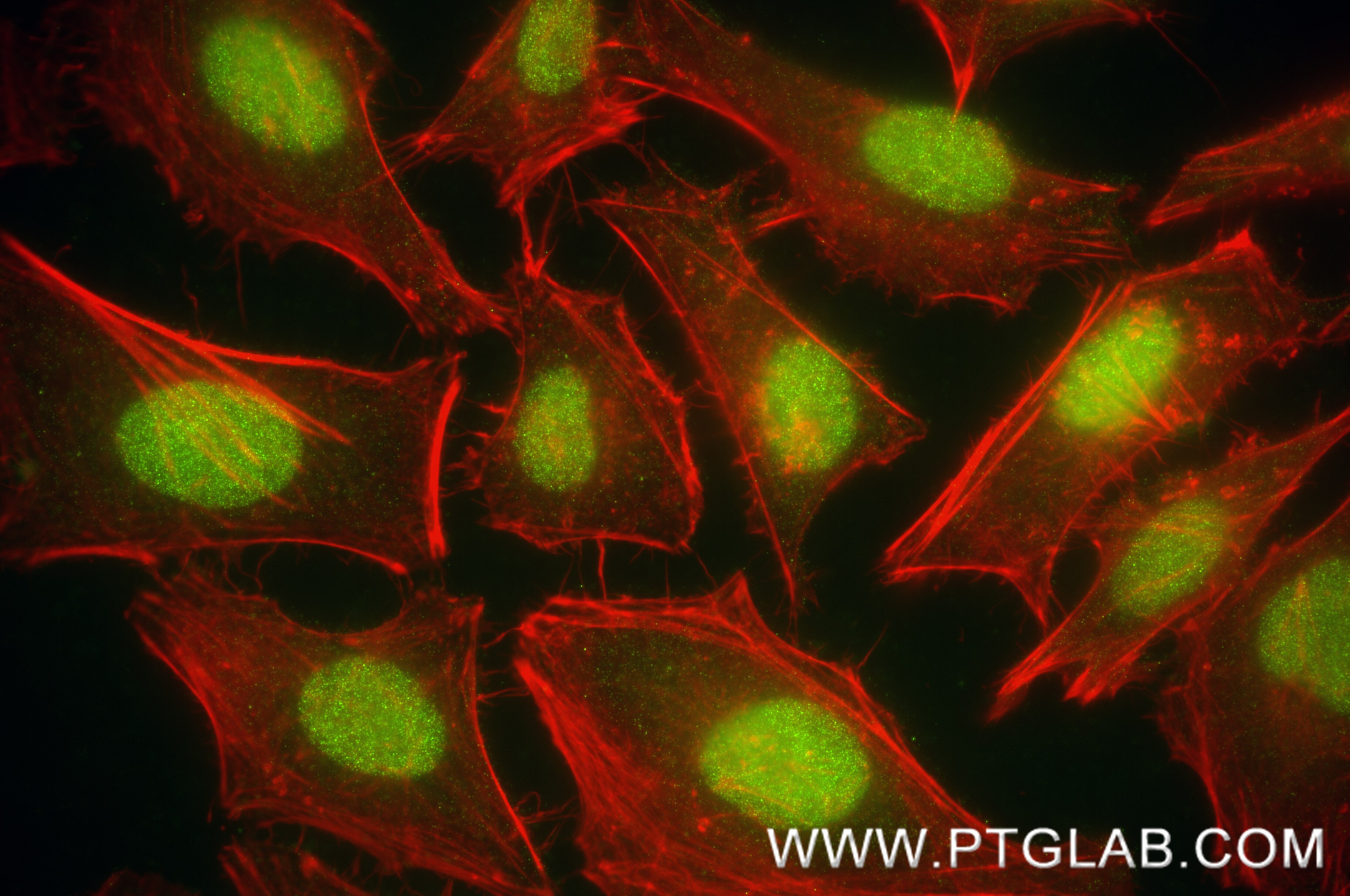 IF Staining of HeLa using 87979-1-RR (same clone as 87979-1-PBS) Immunofluorescence (IF) / fluorescent staining of HeLa cells using MTA1 Recombinant monoclonal antibody (87979-1-RR)