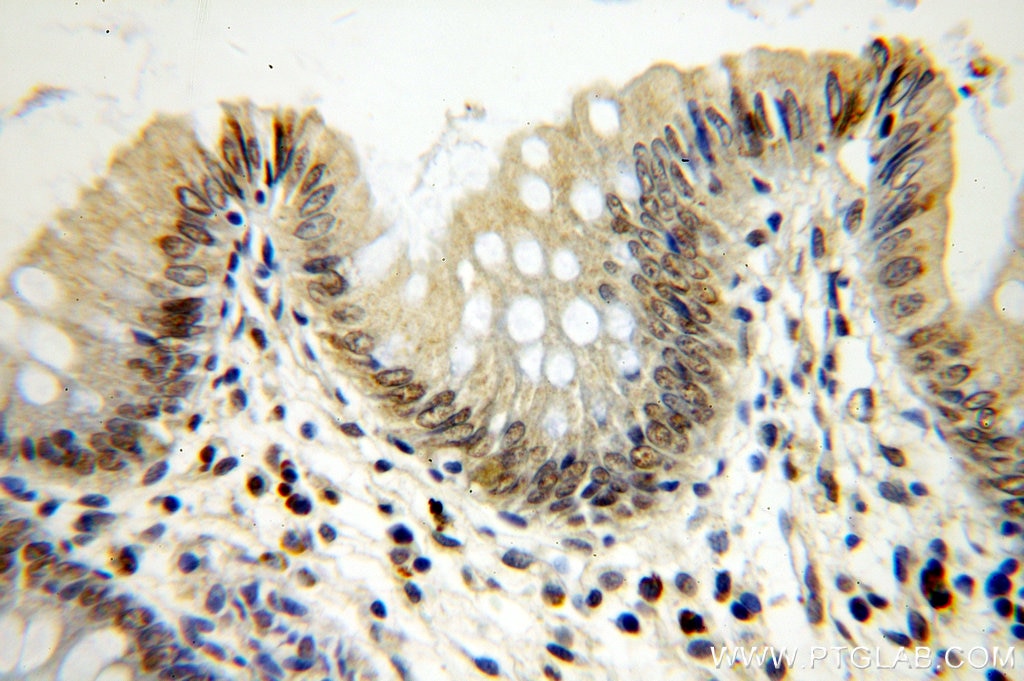 Immunohistochemistry (IHC) staining of human colon tissue using MTA2 Polyclonal antibody (17554-1-AP)