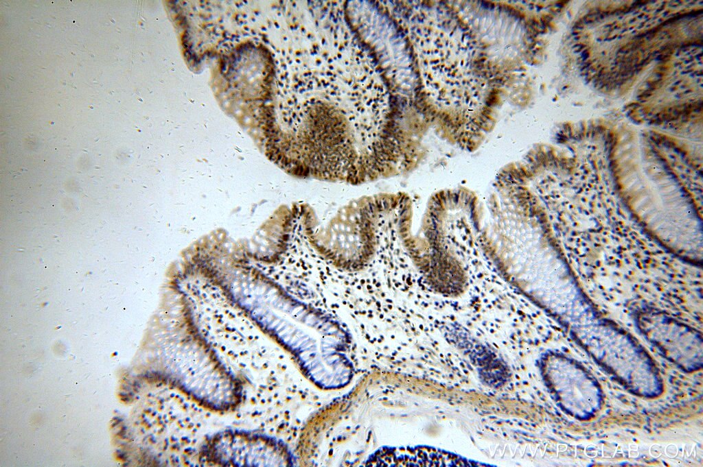 Immunohistochemistry (IHC) staining of human colon tissue using MTA2 Polyclonal antibody (17554-1-AP)