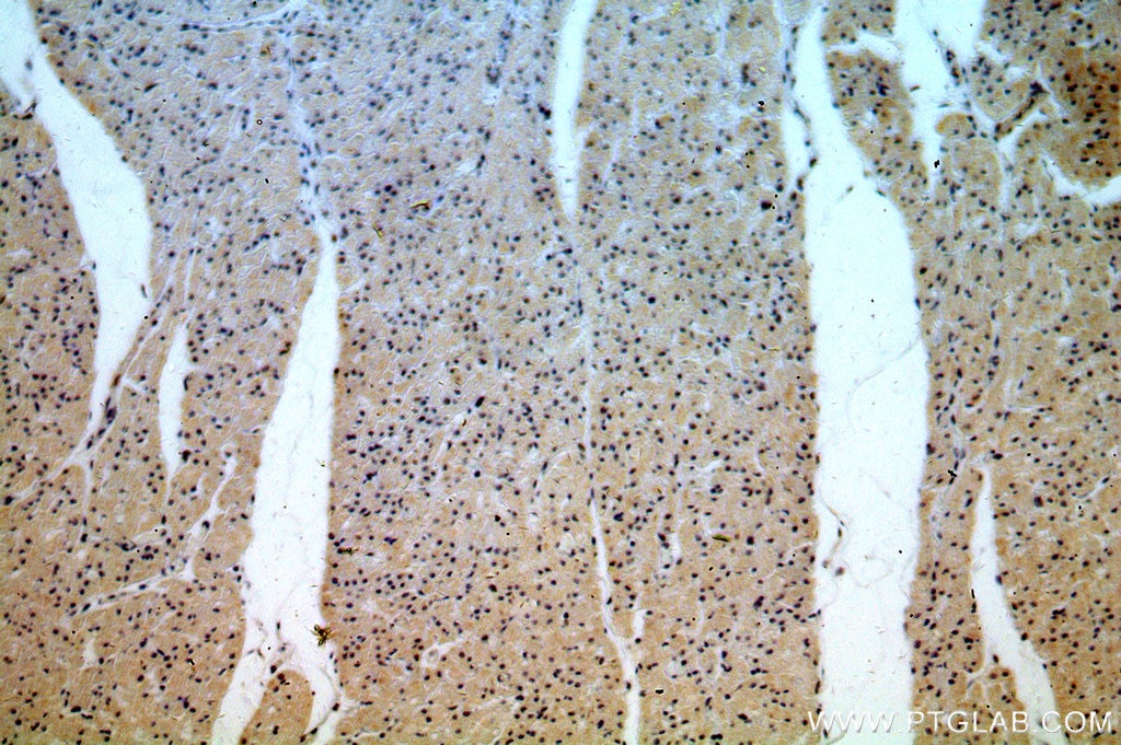 Immunohistochemistry (IHC) staining of human heart tissue using MTA2 Polyclonal antibody (17554-1-AP)