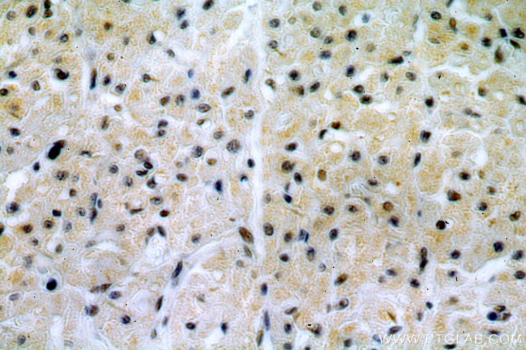 Immunohistochemistry (IHC) staining of human heart tissue using MTA2 Polyclonal antibody (17554-1-AP)