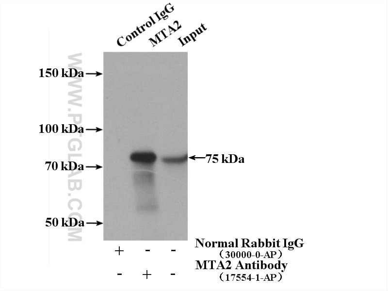 Immunoprecipitation (IP) experiment of mouse thymus tissue using MTA2 Polyclonal antibody (17554-1-AP)