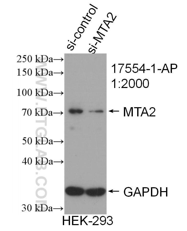 Western Blot (WB) analysis of HEK-293 cells using MTA2 Polyclonal antibody (17554-1-AP)