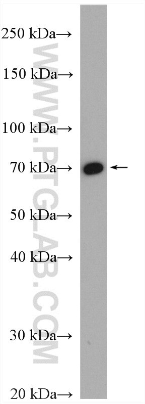 Western Blot (WB) analysis of Jurkat cells using MTA2 Polyclonal antibody (17554-1-AP)