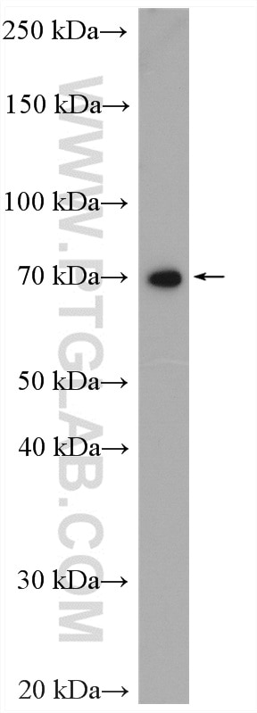 Western Blot (WB) analysis of HeLa cells using MTA2 Polyclonal antibody (17554-1-AP)