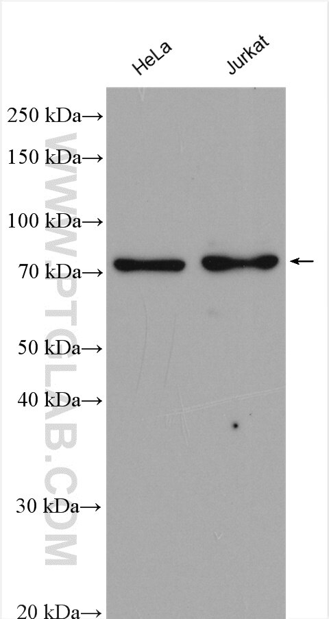 Western Blot (WB) analysis of various lysates using MTA2 Polyclonal antibody (17554-1-AP)