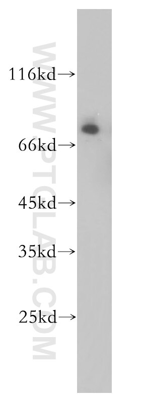 Western Blot (WB) analysis of mouse thymus tissue using MTA2 Polyclonal antibody (17554-1-AP)