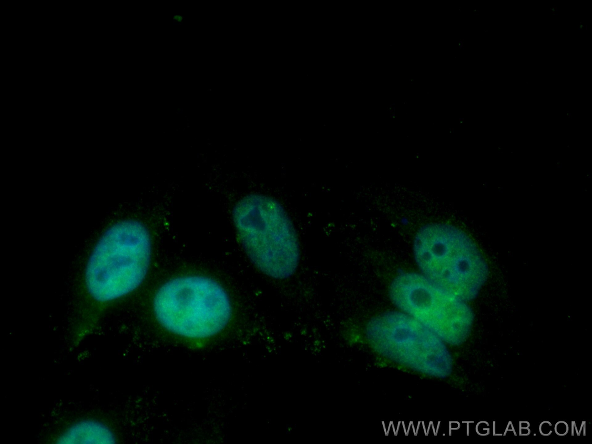 Immunofluorescence (IF) / fluorescent staining of HepG2 cells using MTA2 Monoclonal antibody (66195-1-Ig)