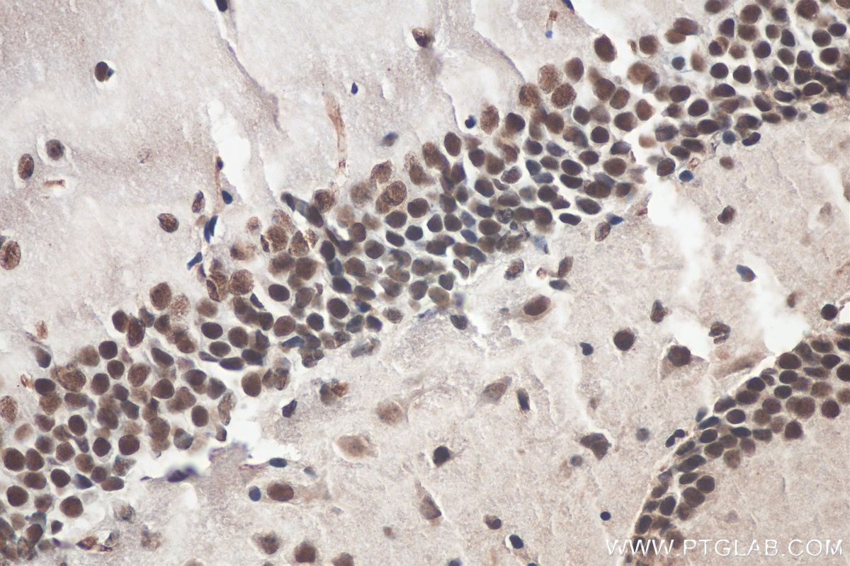Immunohistochemistry (IHC) staining of mouse brain tissue using MTA2 Monoclonal antibody (66195-1-Ig)