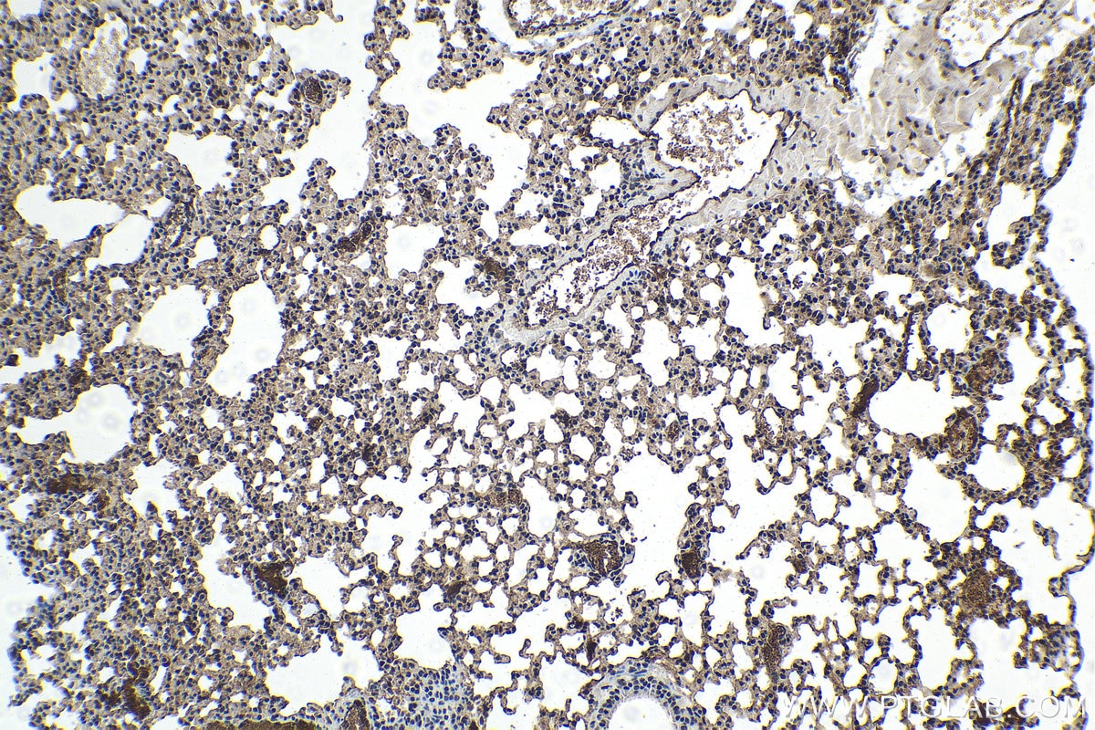 Immunohistochemistry (IHC) staining of mouse lung tissue using MTA2 Monoclonal antibody (66195-1-Ig)