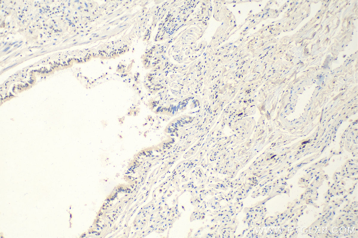 Immunohistochemistry (IHC) staining of human lung tissue using MTA2 Monoclonal antibody (66195-1-Ig)