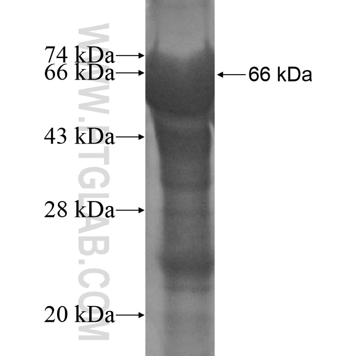 MTA2 fusion protein Ag11713 SDS-PAGE
