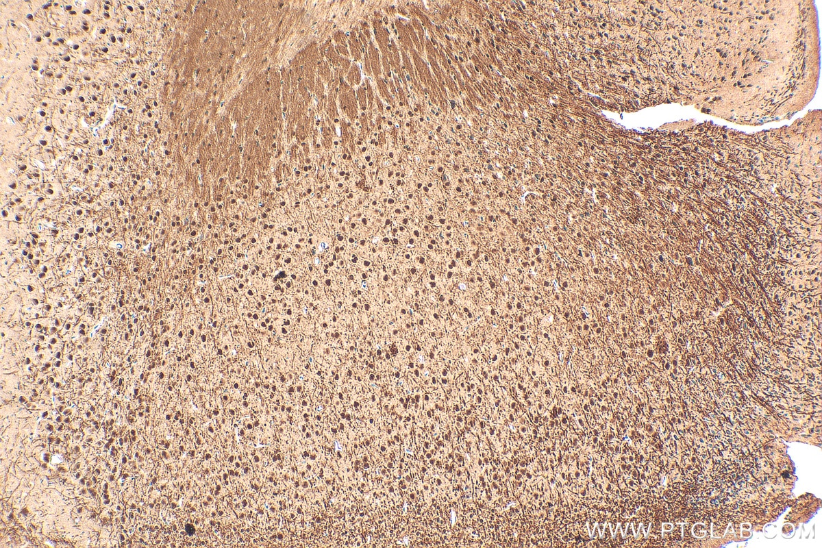 Immunohistochemistry (IHC) staining of mouse brain tissue using MTA3 Polyclonal antibody (14682-1-AP)