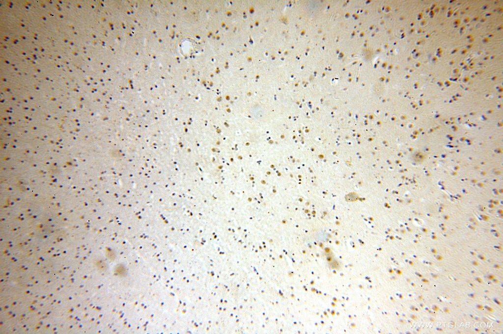 Immunohistochemistry (IHC) staining of human brain tissue using MTA3 Polyclonal antibody (14682-1-AP)