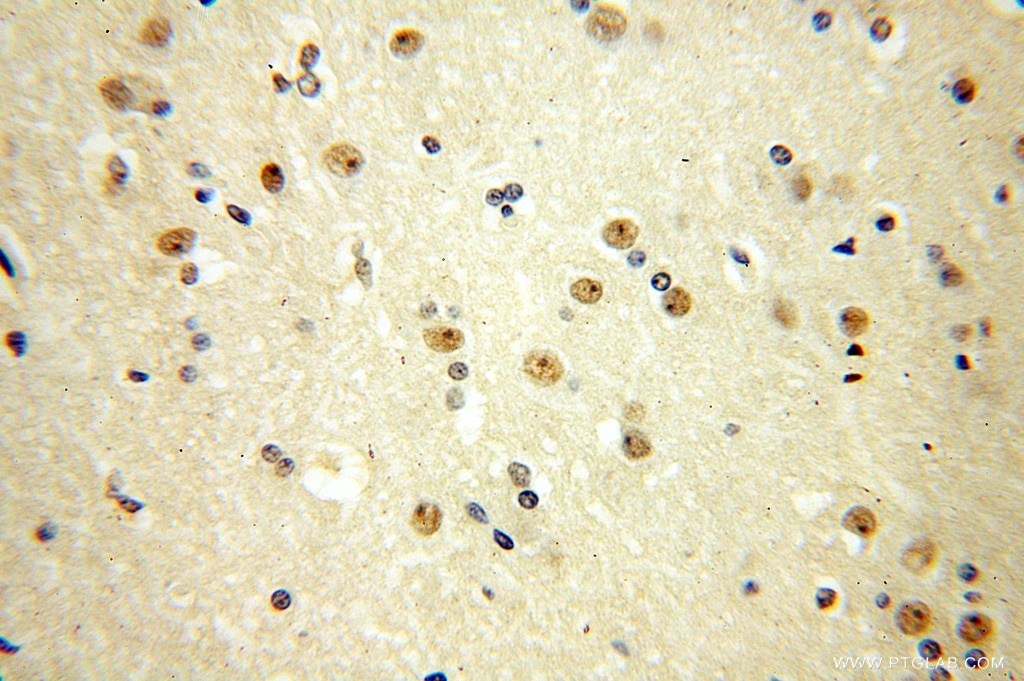 Immunohistochemistry (IHC) staining of human brain tissue using MTA3 Polyclonal antibody (14682-1-AP)