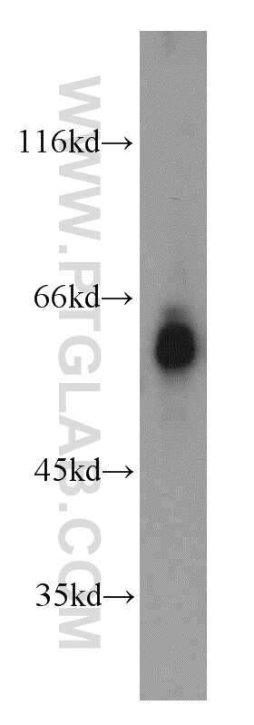 Western Blot (WB) analysis of Jurkat cells using MTA3 Polyclonal antibody (14682-1-AP)