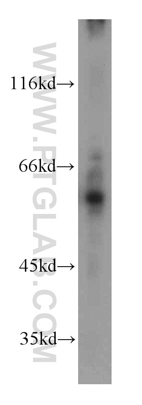 Western Blot (WB) analysis of Jurkat cells using MTA3 Polyclonal antibody (14682-1-AP)