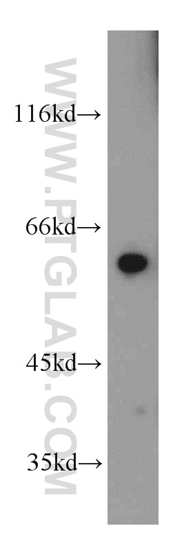 Western Blot (WB) analysis of mouse thymus tissue using MTA3 Polyclonal antibody (14682-1-AP)
