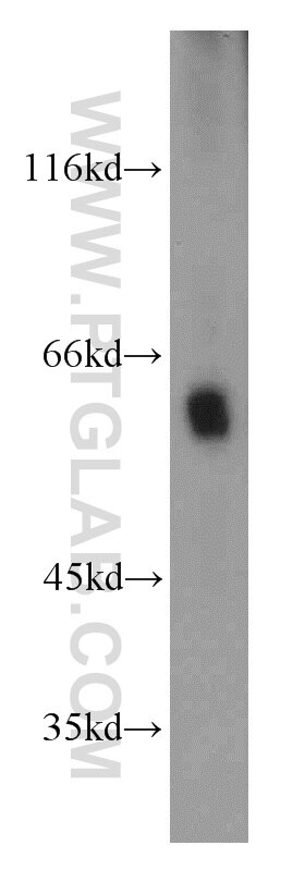 Western Blot (WB) analysis of MCF-7 cells using MTA3 Polyclonal antibody (14682-1-AP)