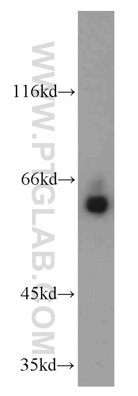 Western Blot (WB) analysis of Raji cells using MTA3 Polyclonal antibody (14682-1-AP)