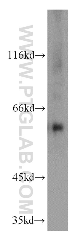 Western Blot (WB) analysis of Raji cells using MTA3 Polyclonal antibody (14682-1-AP)